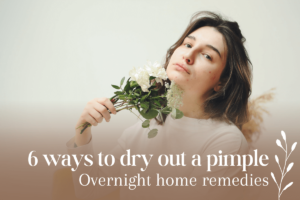 6-ways-to-dry-out-a-pimple