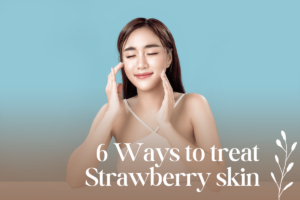 6 ways to treat strawberry skin