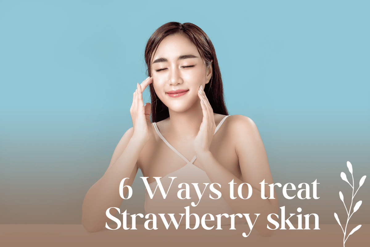 6 ways to treat strawberry skin